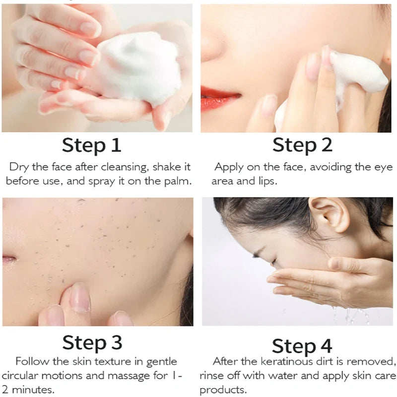 Mousse Exfoliante de Romero 60ml | Limpieza Facial Control Grasa