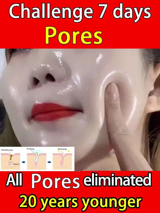Sérum Facial Retinol y Niacinamida – Refina Poros, Ilumina y Textura Uniforme | No Comedogénico