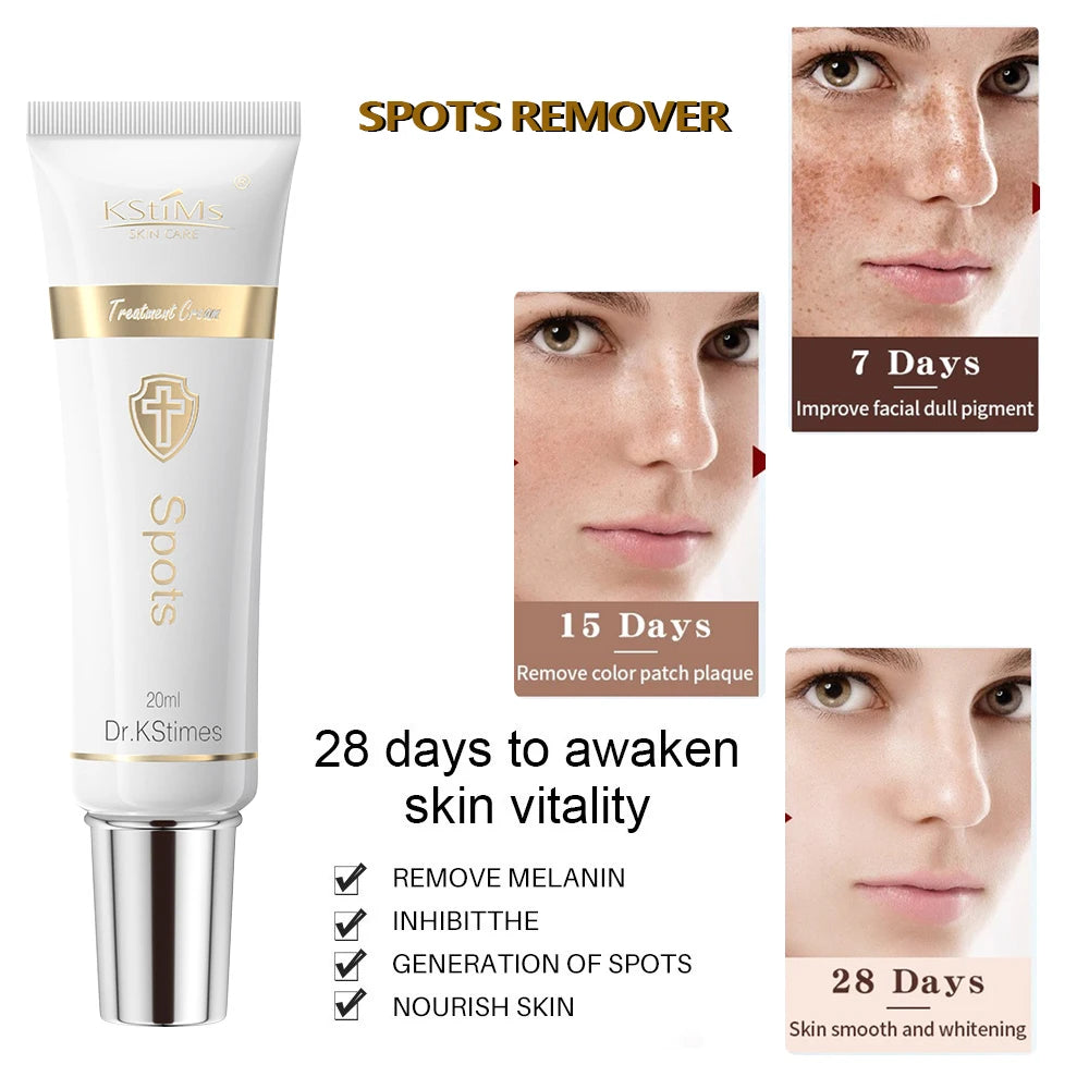Crema Blanqueadora Facial Coreana – Ilumina y Elimina Manchas Oscuras