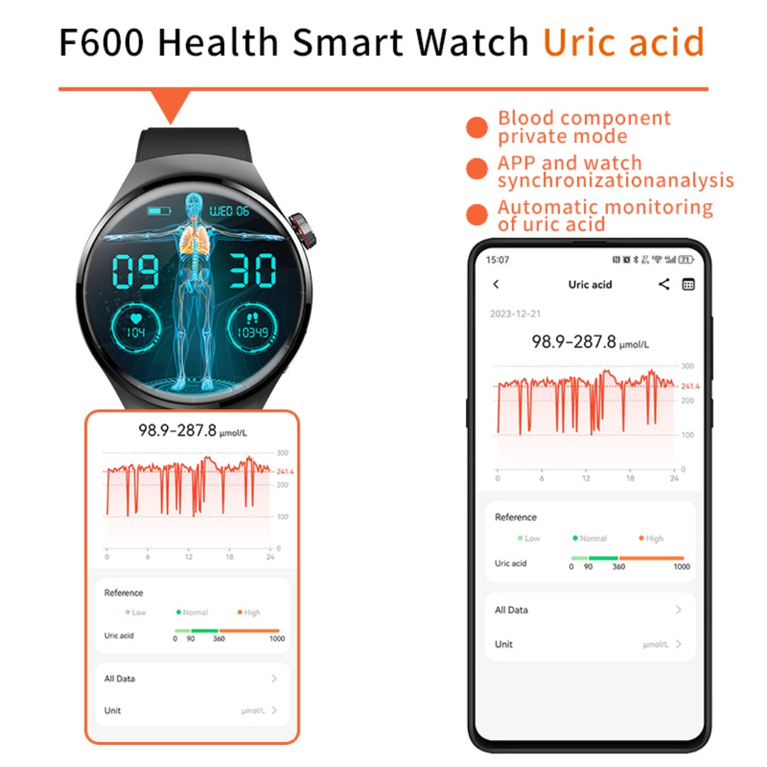 Smartwatch Disco 1.55" - Monitor de Salud y Gestor de Bienestar 2025