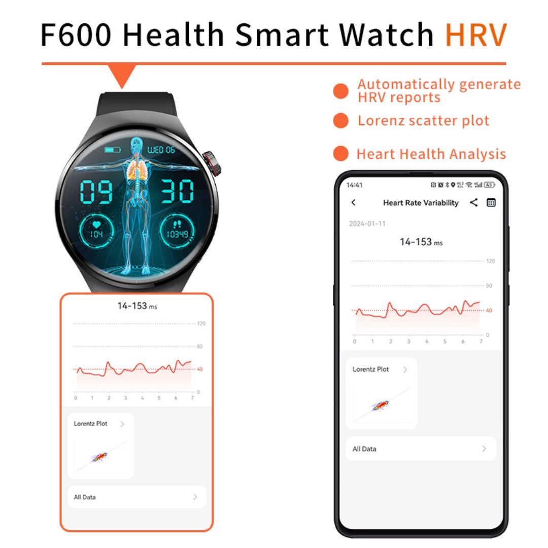 Smartwatch Disco 1.55" - Monitor de Salud y Gestor de Bienestar 2025