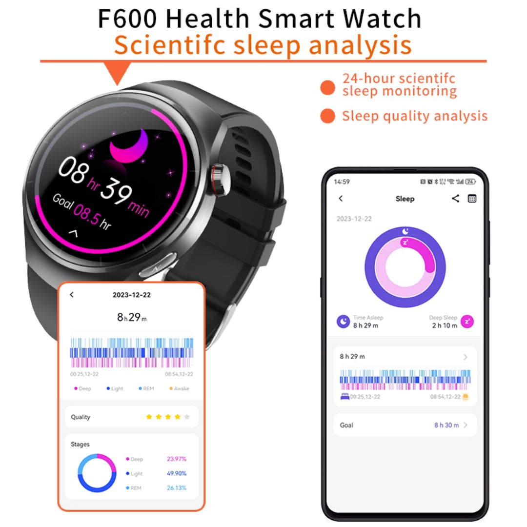Smartwatch Disco 1.55" - Monitor de Salud y Gestor de Bienestar 2025