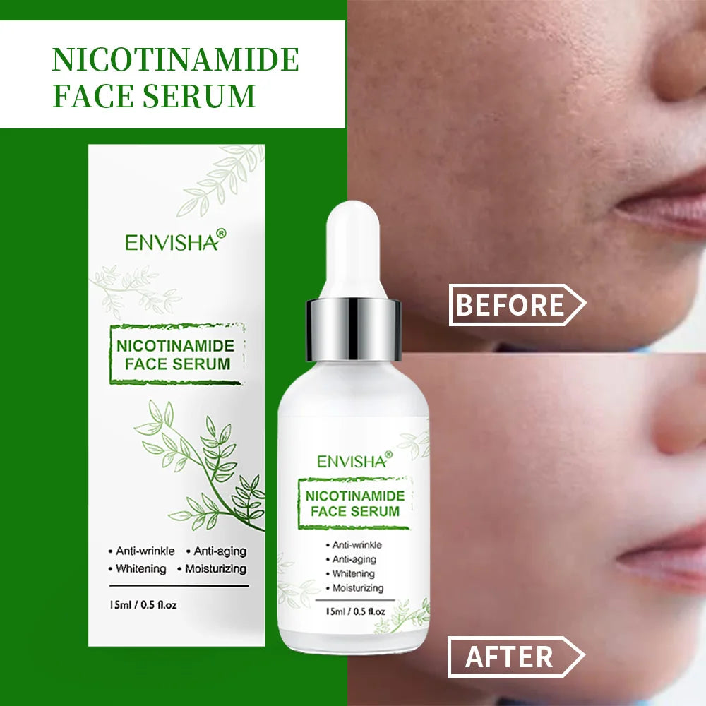 Sérum Facial Niacinamida + Colágeno + Retinol – Antiedad, Blanqueador y Control de Poros 15ml