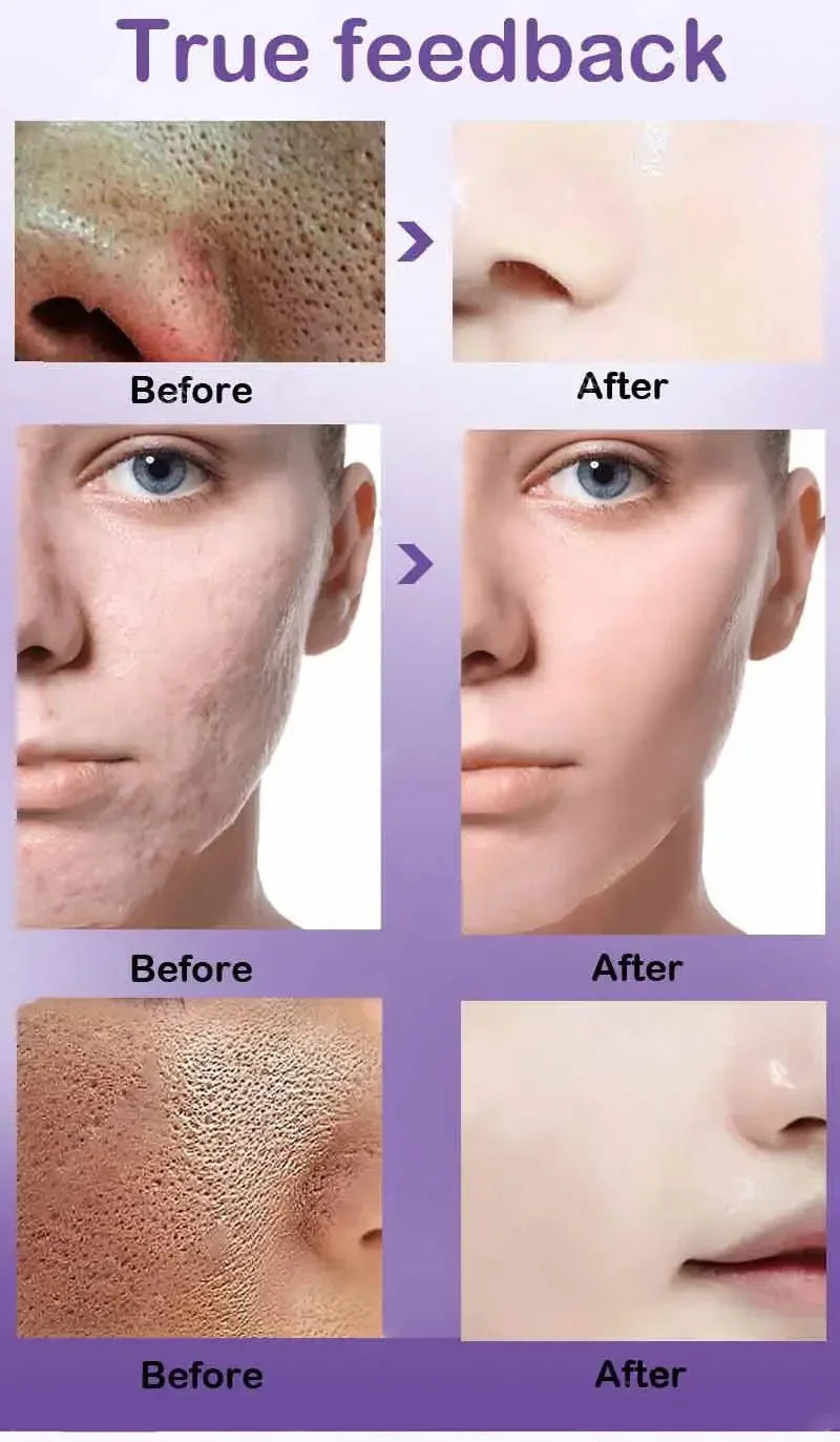 Sérum Facial Retinol y Niacinamida – Refina Poros, Ilumina y Textura Uniforme | No Comedogénico