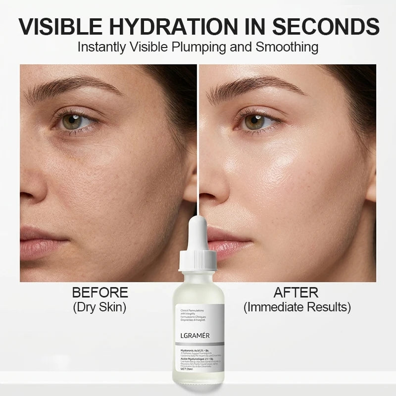 Sérum Ácido Hialurónico 2% + B5 Eelhoe – Hidratante, Reductor de Manchas y Antioxidante 30ml