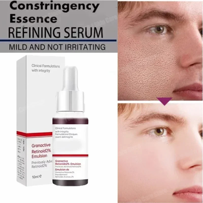 eelhoe Sérum Minimizador de Poros 10ml – Repara, Suaviza y Reafirma la Piel Facial