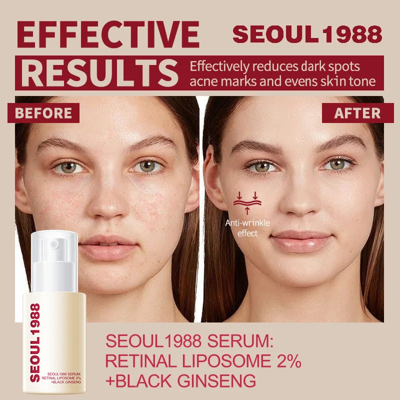 Seoul 1988 Sérum Ginseng Negro Coreano – Retinol, Niacinamida y Vitamina C | Ampolla Facial