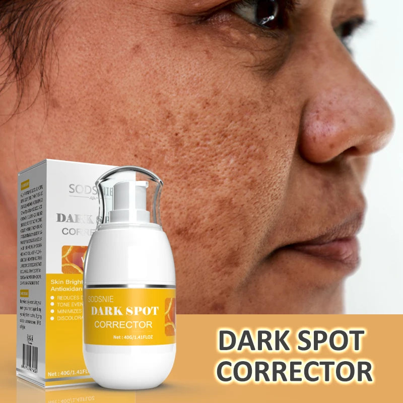 Vitamins Remove Dark Spots Lighten Sun Spots Freckles Melasma Pigmentation Whitening Cream Anti-Aging Brightening Skin Care 40g