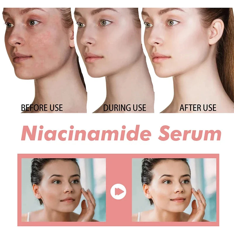 Dragon Blood Advanced Serum Effective Resist Aging Tighten Skin Reduce Wrinkles Brighten Skin Tone Improve Dullness Face Essence