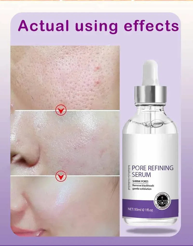 Sérum Facial Retinol y Niacinamida – Refina Poros, Ilumina y Textura Uniforme | No Comedogénico