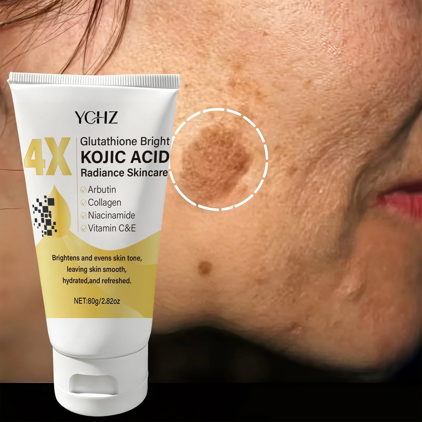 Crema Ácido Kójico 80g – Unifica Tono, Elimina Manchas y Humecta Día y Noche