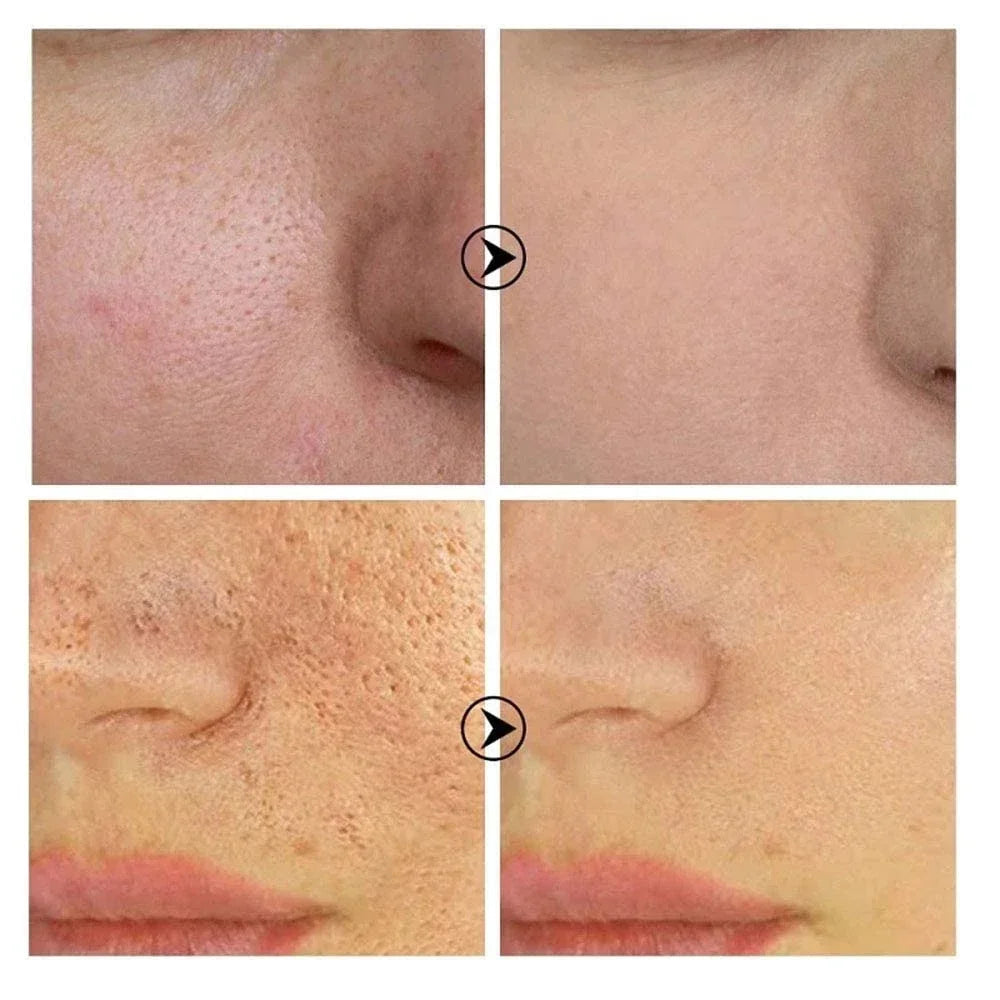 Sérum Facial Retinol y Niacinamida – Refina Poros, Ilumina y Textura Uniforme | No Comedogénico