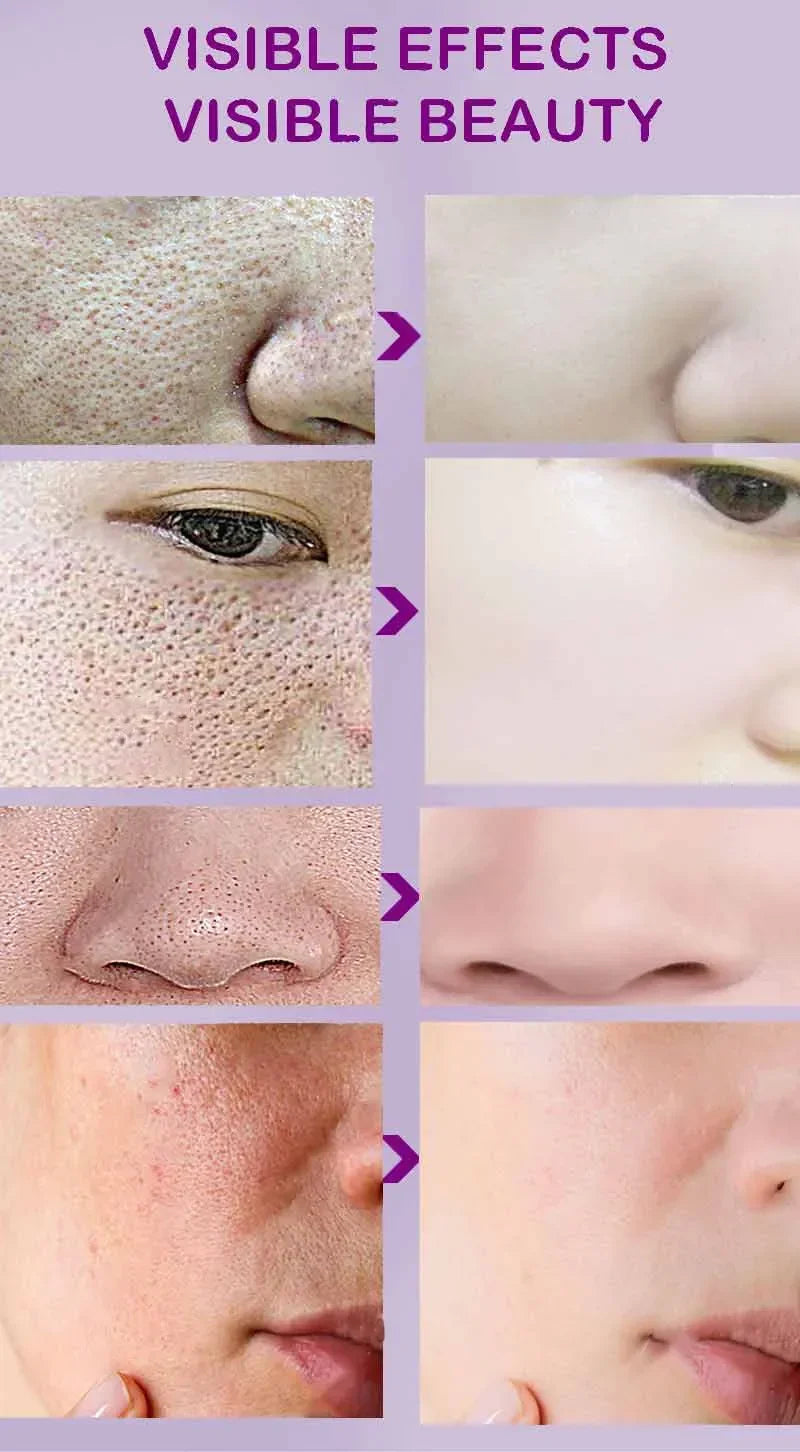 Sérum Facial Retinol y Niacinamida – Refina Poros, Ilumina y Textura Uniforme | No Comedogénico