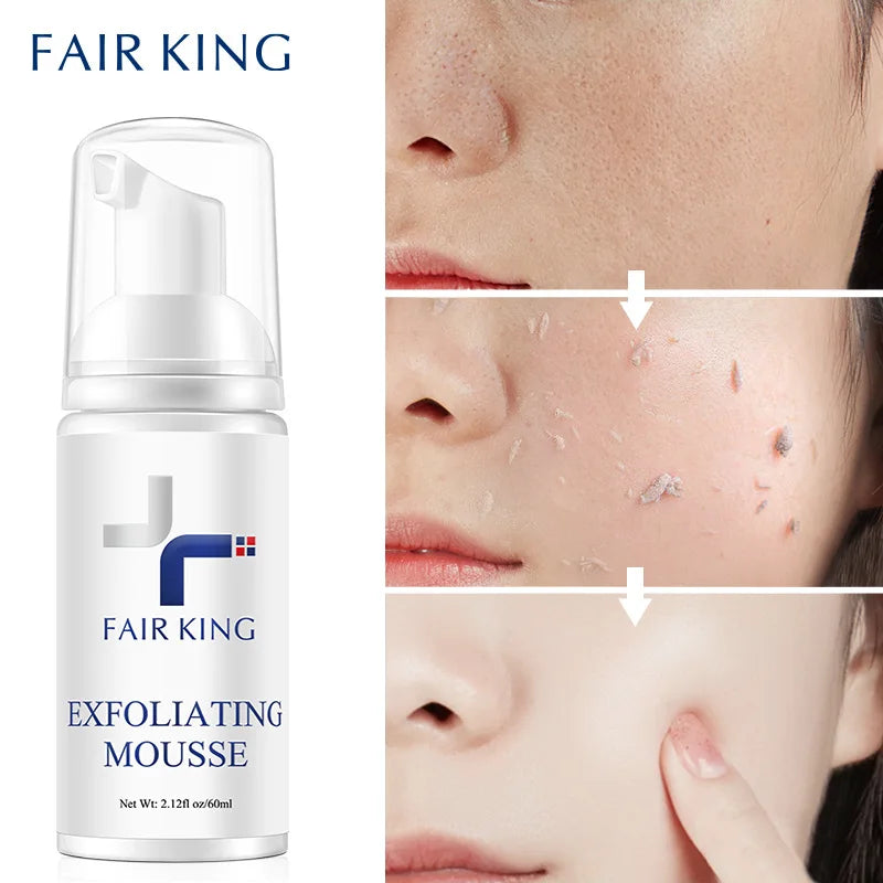 Mousse Exfoliante Limpiador Facial Romero Control Aceite Poros - Desmaquillante Suave Textura Piel 60ml
