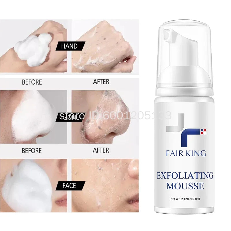 Mousse Exfoliante Limpiador Facial Romero Control Aceite Poros - Desmaquillante Suave Textura Piel 60ml